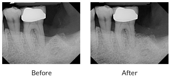 br-case2